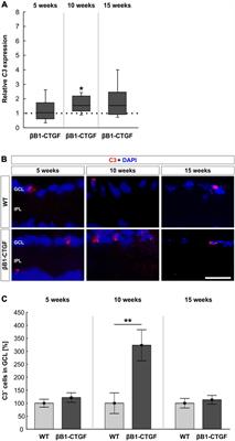 Cytokine and Complement Response in the Glaucomatous βB1-CTGF Mouse Model